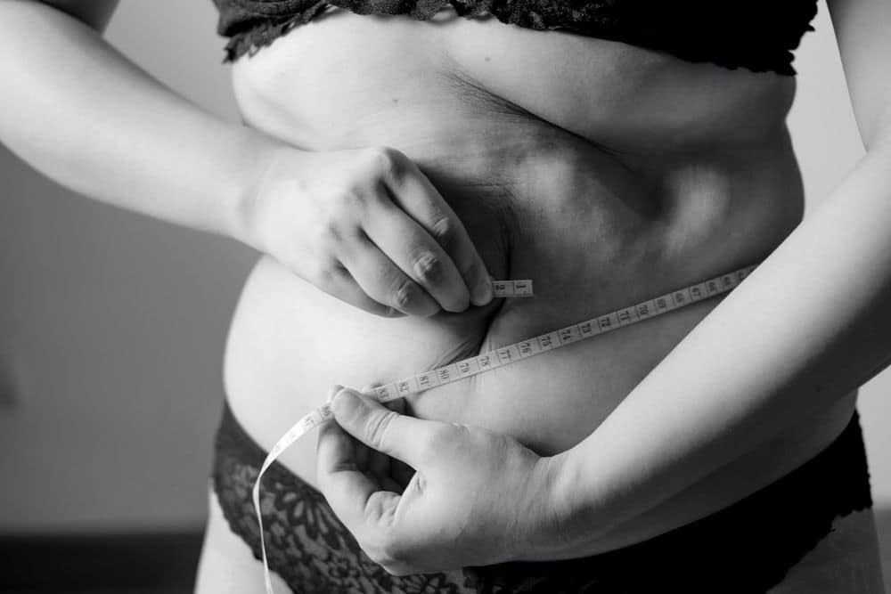 Übergewichtige Frau in Unterwäsche hält sich ein Maßband um den Bauch.
